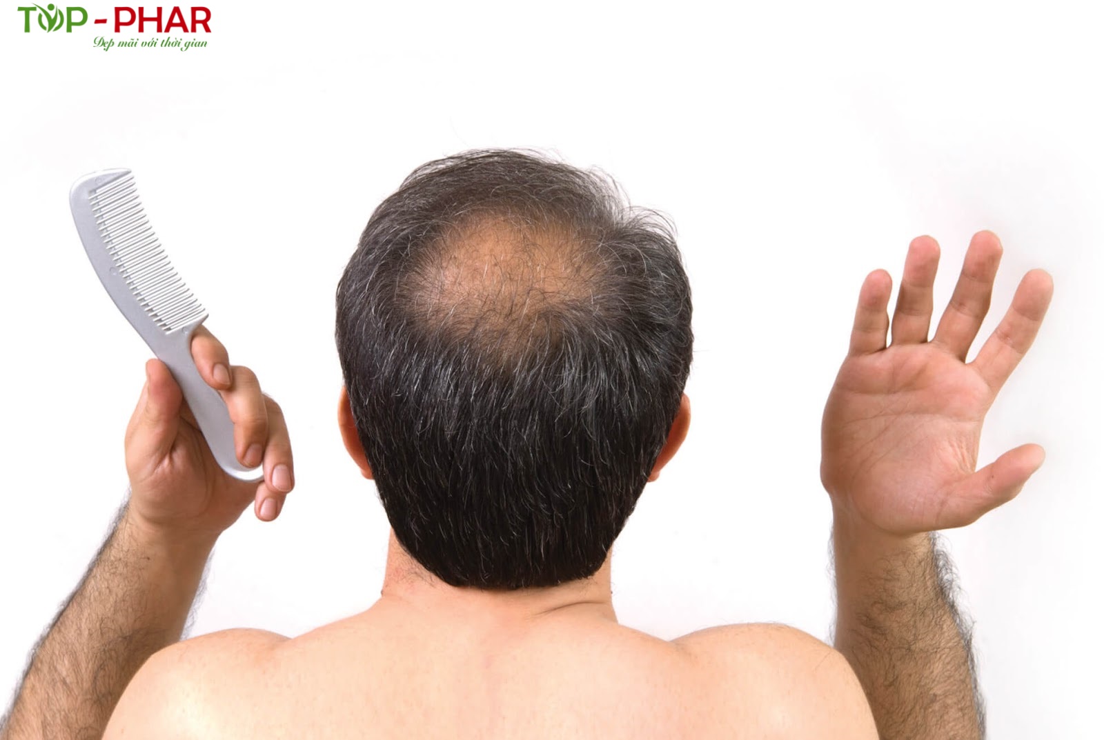 Rụng tóc nhiều ở nam giới là bệnh gì? Địa chỉ chữa rụng tóc uy tín